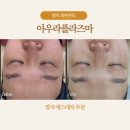 아우라케어 | 명지 피부관리 아우라플라즈마에서 받은 스페셜케어 후기 혈류순환 윤곽개선까지