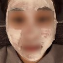 더한한의원 | 천안 여드름 한의원 불당동 새살침 관리 후기