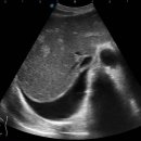 엔도소노 이미지