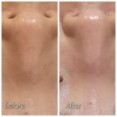 내손중앙로 | [더맑은스킨 의왕내손점] 라인리페어 케어 받고 온 의왕피부관리 후기