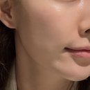 휴먼메디 | 동성로 에스테틱 데자뷰메디스킨 대구점 수분관리 받은 솔직 후기