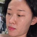 프로디테일(카쎈팩토리) | 페이스팩토리 피코세라 피부 홈케어로 기미제거 얼굴 하얘지는법!