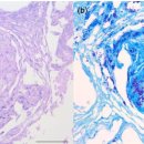 수족관 사육 전어와 정어리의 Mycobacterium pseudoshottsii 감염 이미지