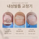 한영정형외과의원 | 수원시 장안구 발톱이 살을 찌르는 통증 원인인 내성발톱입니다