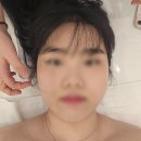 전주에코시티 - &#34;피부야&#34;/피부관리/슈퍼리프팅/브이라인/이중턱 후기