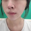 경기광주 피부과 추천｜임신 25주 얼굴 두드러기 치료 후기
