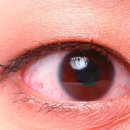 밝은눈한의원 이미지