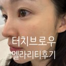 3016 | 광주 수완지구 에스테틱 추천 : 광주 터치브로우 멜라리티 시술 후기