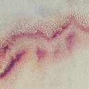 부산큰병원(급식실 포함) | 부산광역시 일요일 진료 피부과 문 여는 병원 빠르게 찾는 법
