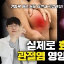 허리 통증, 무릎 통증에 즉각적인 통증을 없애주는 관절염 영양제 조합 (퇴행성 관절염 영양제 / 관절 영양제 조합) 이미지