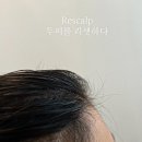 리스칼프 이미지