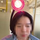 아산 두피 전문 관리 CSLMGF두피탈모센터 솔직 후기