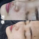 대화역 피부관리 스킨에시아에서 받은 피부 도로공사 세멘부스팅먼트 찐 시술 후기
