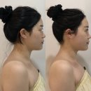 컴포즈커피 전남장성역점 | 광주 신부관리 추천! 오월에스테틱 JH윤곽술 받고 만족한 후기