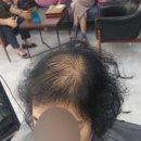 김호증모가발다온헤어