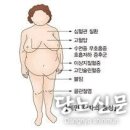 비만은 어떻게 질병을 일으키는가? 이미지