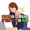 오십견이 진행되는 3가지 단계와 치료 이미지