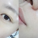 미케어셀 이미지