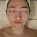 서초동피부관리 트러블 진정 관리 지성피부 웨딩 라인관리 내돈내산 &#39;세컨드샵 에스테틱&#39;
