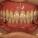 이라인치과기공소 이미지