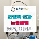 젊은눈안과의원