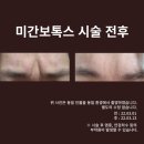 벨포인트의원 네이버블로그