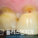 플러스덴치과의원 이미지
