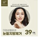 더업성형외과의원 네이버블로그