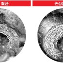 고혈압에 좋은 밥상을 만들기 이미지