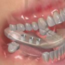 청담뷰치과의원 이미지