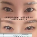 천안속눈썹 리얼 후기｜래쉬애딕트 사용 전·후, 왜 속눈썹은 관리가 달라야 할까?