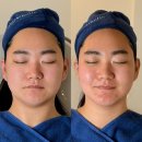 행복한피부전문관리샵 | 나주 미모오른 에스테틱 / 나주 피부샵 신부관리 피부관리 추천 / 알테온 리프팅 후기