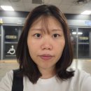 서울하얀의원 | 압구정 루나의원 루비레이저 600샷 후기 (시술직후, 1일차, 6개월차 전후 비교)