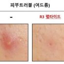 셀리버리 리빙앤헬스, 'R3 펩타이드' 효과적인 인체적용시험결과 확인...'피부트러블·안티에이징 효과' 이미지