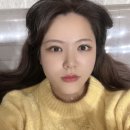 안성민성형외과의원 | 내돈내산) 눈매교정 웟트임 앞트임 1일~일주일차 수술전후 후기