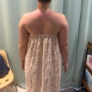 라인메디 | 광주 팔뚝관리 · 승모 관리 받고 라인 정리 되었다! 365메디스킨 광주본점 후기