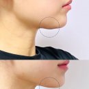 더숨에스테틱 이미지