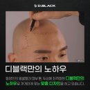 구미 삭발두피문신 SMP 잘하는 곳! 원조두피문신 디블랙아카데미 구미점