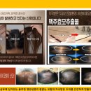 (주)케어포유 네이버블로그
