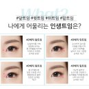 티제이성형외과의원 | 티제이성형외과 트임 잘하는 곳 찾으신다면?