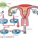 상록수보건소, 체외수정 시술비 4회까지 지원 이미지