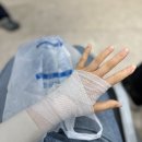 미각 | 항생제 부작용 미각 이상 후기