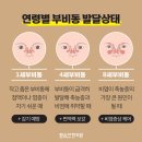 함소아한의원서대전 네이버블로그