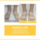 동경한의원 | 망상청피반 원인, 증상, 치료법 <총정리> -17년 차 한의사 작성