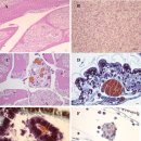 민물산 흰다리 가재 (Austropotamobius pallipes)의 미포자충 Thelohania contejeani 이미지