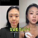 뉴스킨케어 | 땅콩형얼굴 뉴스킨갈바닉 웰스파 내돈내산후기