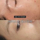 씨유 서영더엘점 | 인천 검단 기미 피부관리 피부과 대신 선택한 비비드엘 에스테틱