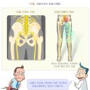 통증N바디테라피 이미지