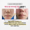 배내스템 좁쌀 여드름이나 트러블에 좋아요!! [ 선사은증정 많이 받아가세요1!]