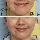 스파이스업 향신료 무중력 엘트리움 일산화정 윤곽관리 후기